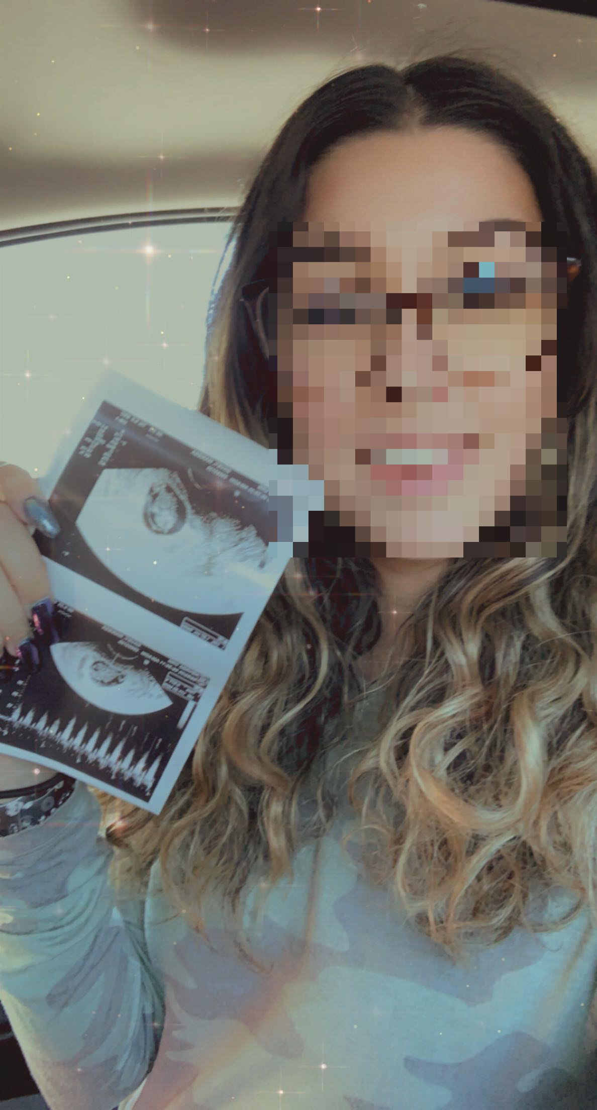 Pregnancy Test Case 3