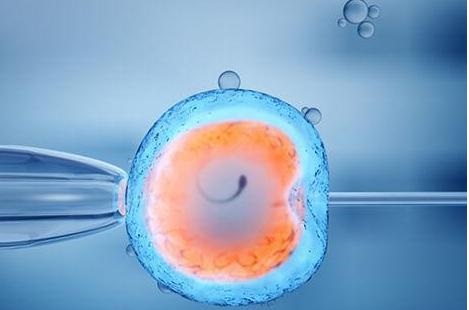 IVF