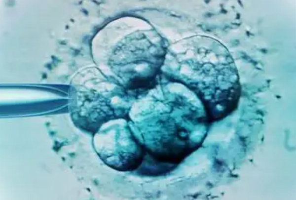 IVF