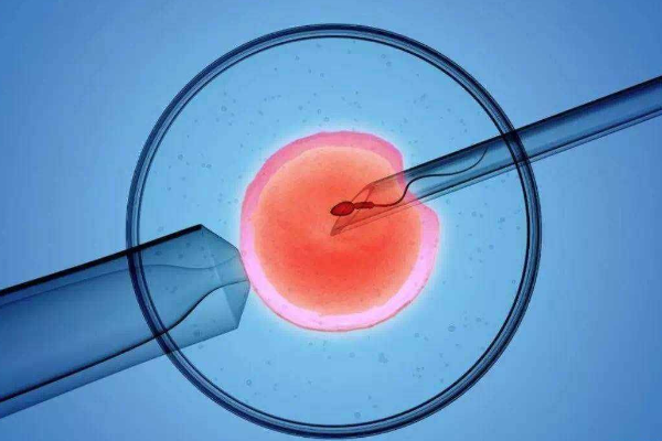 IVF
