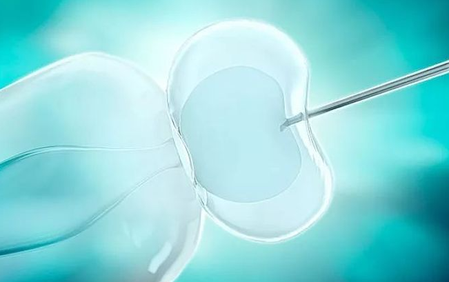 IVF