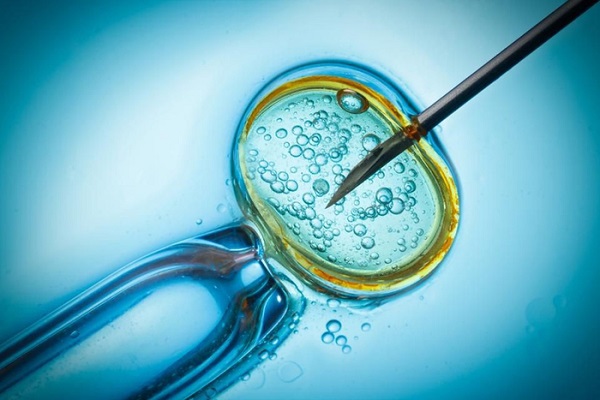 IVF 