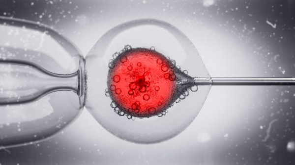 试管婴儿