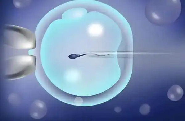 IVF