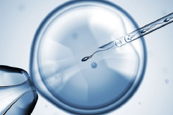 IVF