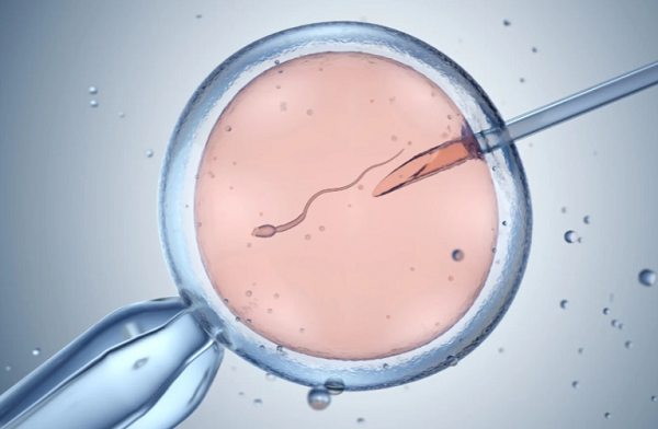 试管婴儿