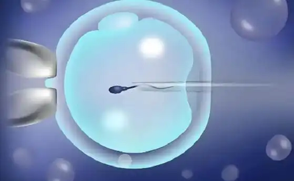 IVF